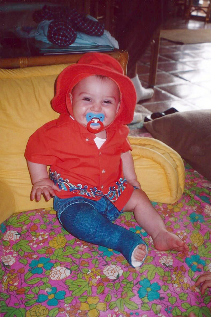 Kalvin 6 months 2nd surgery