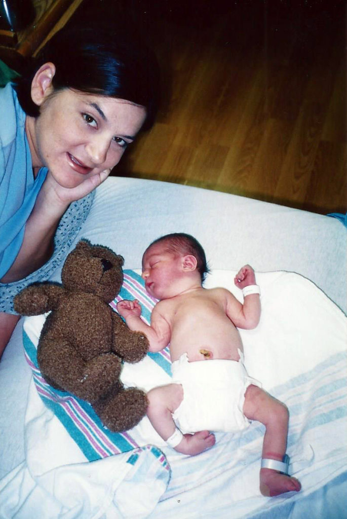 Kalvin newborn clubfoot